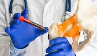 Imagem do pescoço para baixo de um profissional da saúde de jaleto, estetoscópio e luvas, segurando um tubo com sangue e na outra mão um modelo da estrutura de uma medula óssea