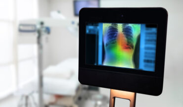 imagem de um ambiente hospitalar, ao fundo existe uma maca vazia e a frente um tablet com o raio-x de uma diagnóstico de câncer de pulmão