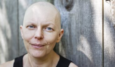 Imagem De Uma Mulher Com Câncer Sorrindo